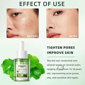 Handelsmarke Cen tella Essence Pore Refining Light ening Beruhigende feuchtigkeit spendende Reparatur Hautpflege Cica Anti Akne Gesichts serum - Product Image 3