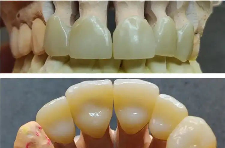 Yucera 4D más bloque de zirconia multicapa Explore material dental con sistema abierto CE ISO CAD CAM 98mm