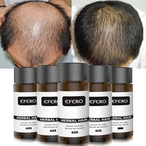 EFERO น้ำมันเจริญเติบโตของเส้นผม20มล.,น้ำมันหอมระเหยช่วยให้ผมร่วงเร็วขึ้นน้ำมันบำรุงผมช่วยฟื้นฟูสภาพการเจริญเติบโตผลิตภัณฑ์ดูแลเส้นผม