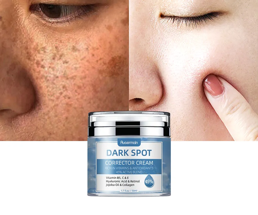 Private Label Korean Face Care Dark Spot Corrector Remover Cream Skin Care Niacinamide Whitening Face Cream for Repairing Face