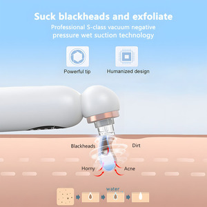 Điện mụn extractor công cụ chân không mặt lỗ chân lông <span class=keywords><strong>Cleaner</strong></span> USB có thể sạc lại mụn đầu đen Remover - Product Image 3