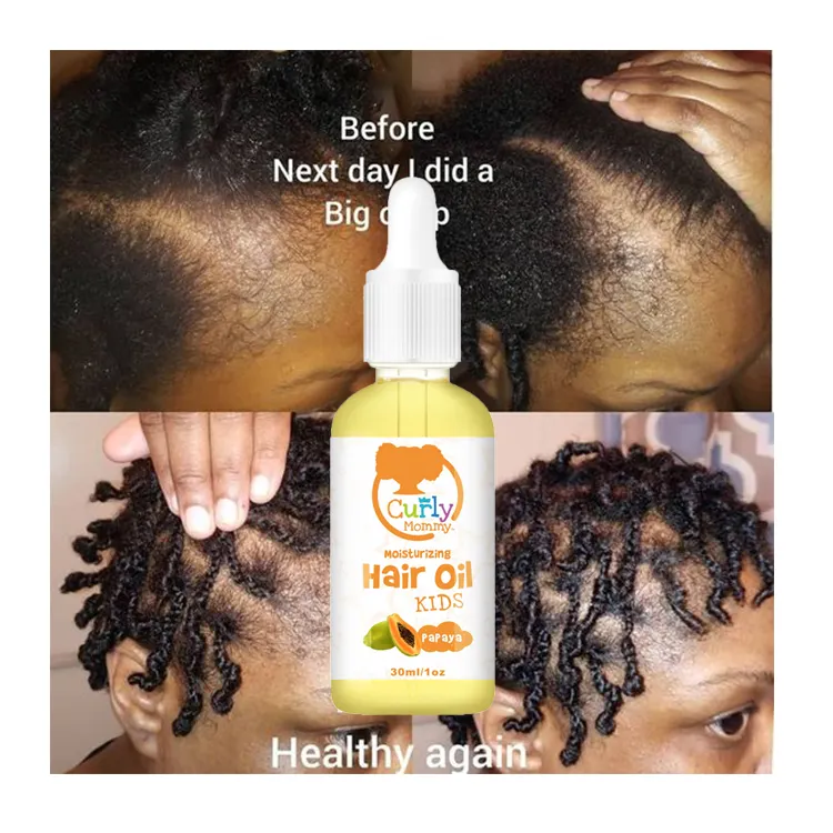 Curlymommy fornecedor de fábrica etiqueta privada orgânico óleo de crescimento do cabelo couro cabeludo estimulador para crianças