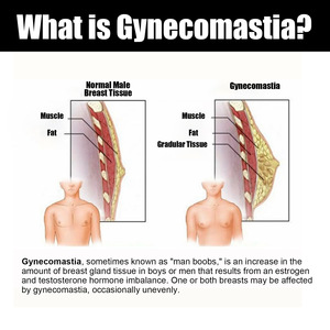 Gynecomastia Reduction Massage <strong>Oil</strong> Remove <strong>Excess</strong> Fat Effectively Shrink Chest Strengthen Muscles Breast Massage Cream for Men - Product Image 5