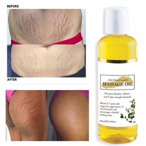 100ml özel etiket streç işareti skar yağı E vitamini ve kollajen cilt sıkılaştırıcı vücut yağı streç işareti kaldırma yağı - Product Image 4