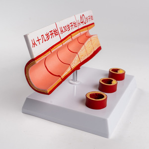 SCIEDU Age <strong>Group</strong> Large Blood Vessel Model 4 Parts <strong>Human</strong> Anatomy Model Sclerosis Cardiovascular Arteriosclerosis Pathology Model
