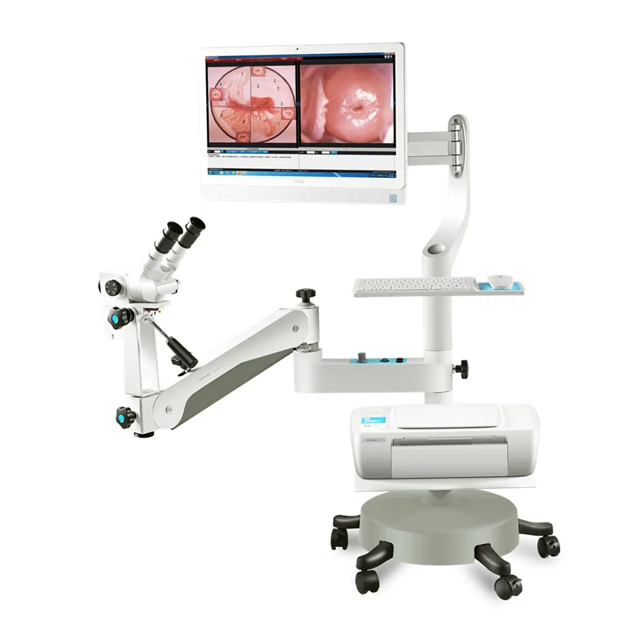 Colposcope à noyau jumelles KN-2200BII vision optique colposcope vidéo pour examen gynécologique