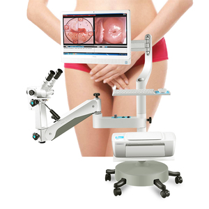 Colposcopio Digital Led para detección de cáncer Cervical, Colposcopio Hd, endoscopio de luz médica - Product Image 1