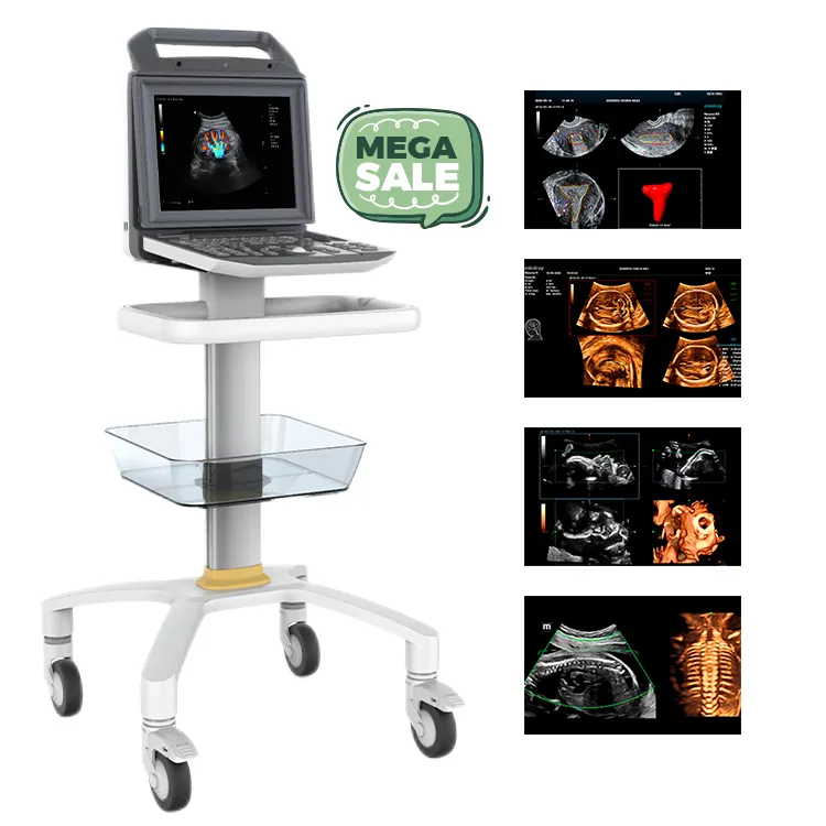 12,1 дюймов светодиодный монитор 3D 4D Портативный Цветной Допплер полный цифровой ультразвуковой аппарат для диагностики