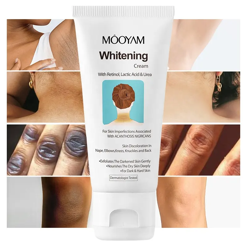 Haut aufhellung creme Acanthosis Nigricans Entfernen Sie schwarze Flecken Dark Spot Corrector Knie Ellenbogen Achsel hals Aufhellung creme