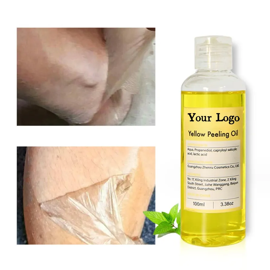 OEM ilumina as manchas escuras peeling ácido óleo natural descascar óleo branqueamento private label amarelo peeling óleo extra fortalece