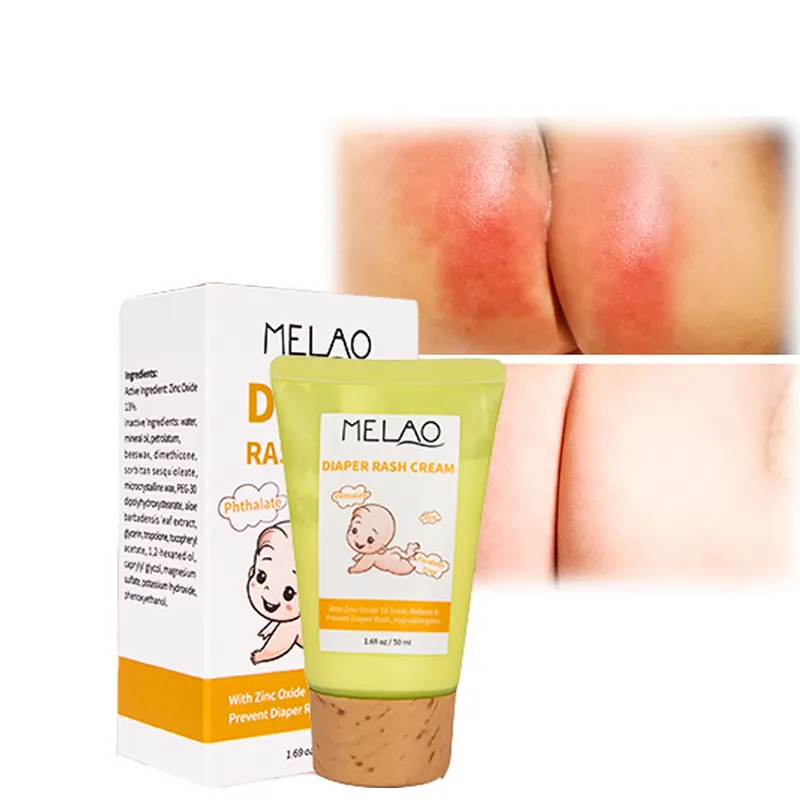 Fralda de bebê orgânico natural, venda no atacado da etiqueta privada, creme para hidratação, cuidados com a pele do bebê