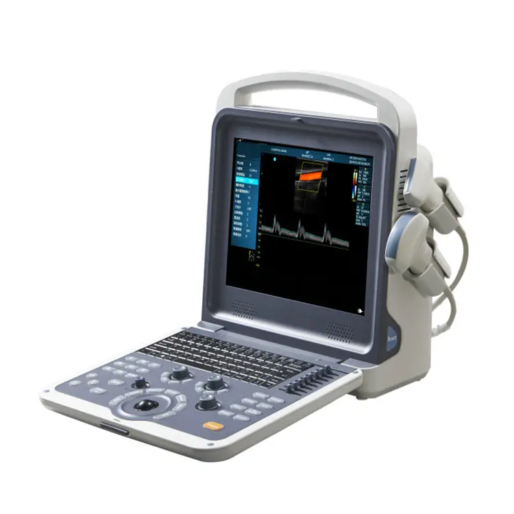 UCD01 China Precio de fábrica Full Digital Color Doppler Máquina de diagnóstico por ultrasonido