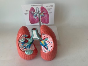 Comparison Lung Model Between Human Smoking and Drug Lung Model for Teaching Use <strong>Explanation</strong> in Hospital - Product Image 5