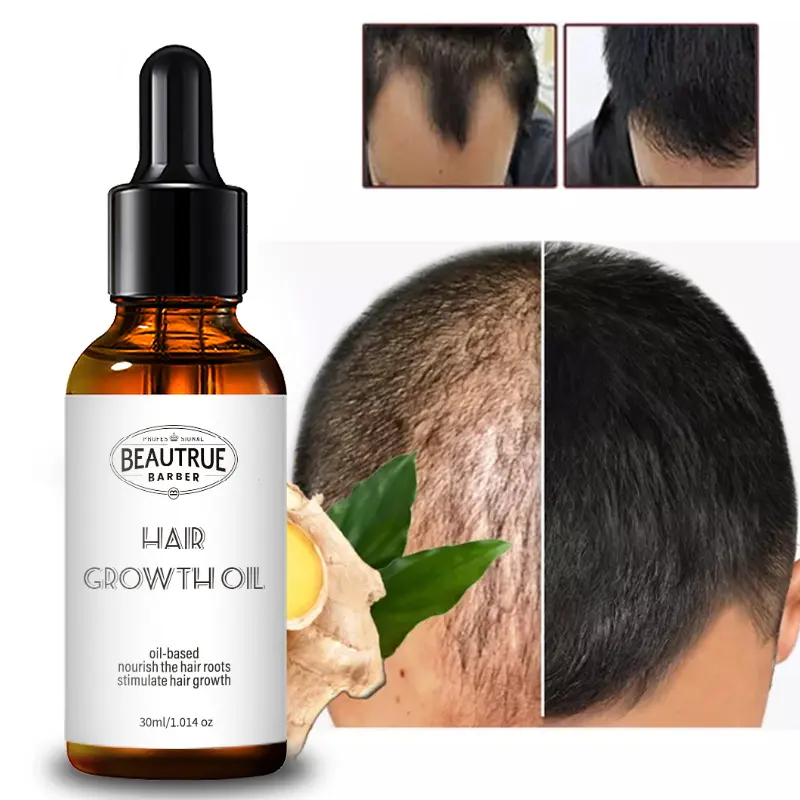 Serum Dày Mọc Tóc Dầu Gừng Kiểm Soát Dầu Mọc Tóc Chống Rụng Tóc Cho Nam