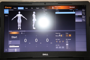 Best Result FPD 17*17'' Digital X-ray Flat Panel Detector for Veterinary and Human - Product Image 5