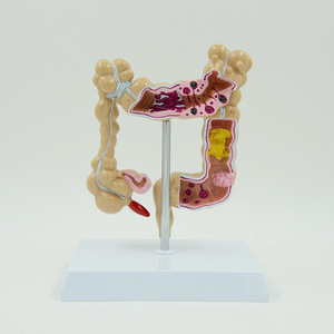 Tıbbi model beyin anorektal doktor-hasta İletişimi anatomik model insan bağırsak modeli - Product Image 5