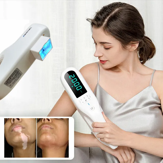 Dispositivo de tratamento a laser portátil, terapia de luz de casa, lâmpada uv para psoríase, vitiligo, eczema, 308nm, excimer, venda imperdível