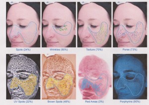 Analizador de piel de última tecnología de fábrica real con máquina de belleza de hidrodermoabrasión con chorro de oxígeno integrada en el sistema informático - Product Image 6