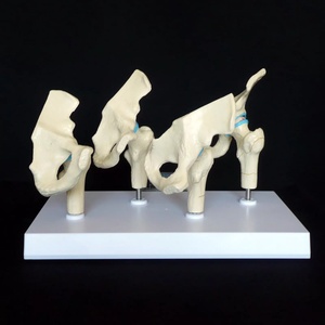 KyrenMed 4ステージ股関節変形性関節症解剖モデルヒト4ステージ関節炎ヒップモデル股関節変性骨格モデル - Product Image 3