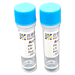 <span class=keywords><strong>Kit</strong></span> de dissociation des annélides opération facile produit une suspension unicellulaire à haute viabilité à partir d'échantillons de tissus d'annélides frais - Product Image 2