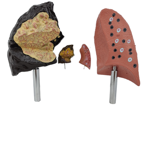 Comparison Model Between Normal Human Lungs Smoking/Drug-Using Lungs Medical Science Product Comprehensive <strong>Explanation</strong> Basis - Product Image 1