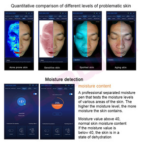Analizador de piel facial 3D AI con pantalla de 15,6 pulgadas, máquina de escáner facial con espejo mágico para análisis de piel en varios idiomas para uso comercial
