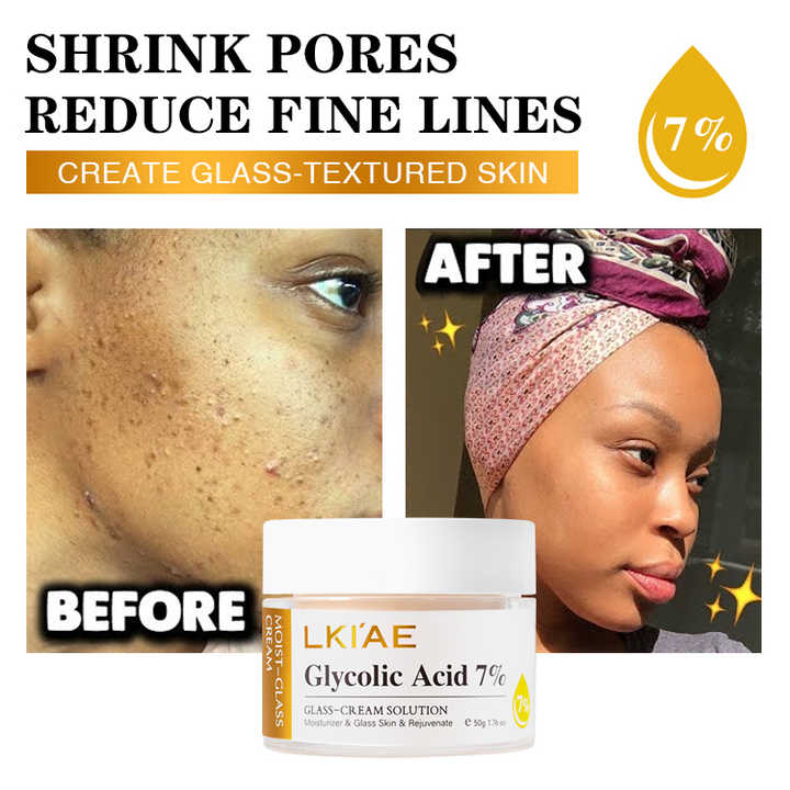 LKIAE Glass Skin Rejuvenate Moisturizing Glycolic Acid Dark Spot Removing Antiwrinkle Whitening Face Cream