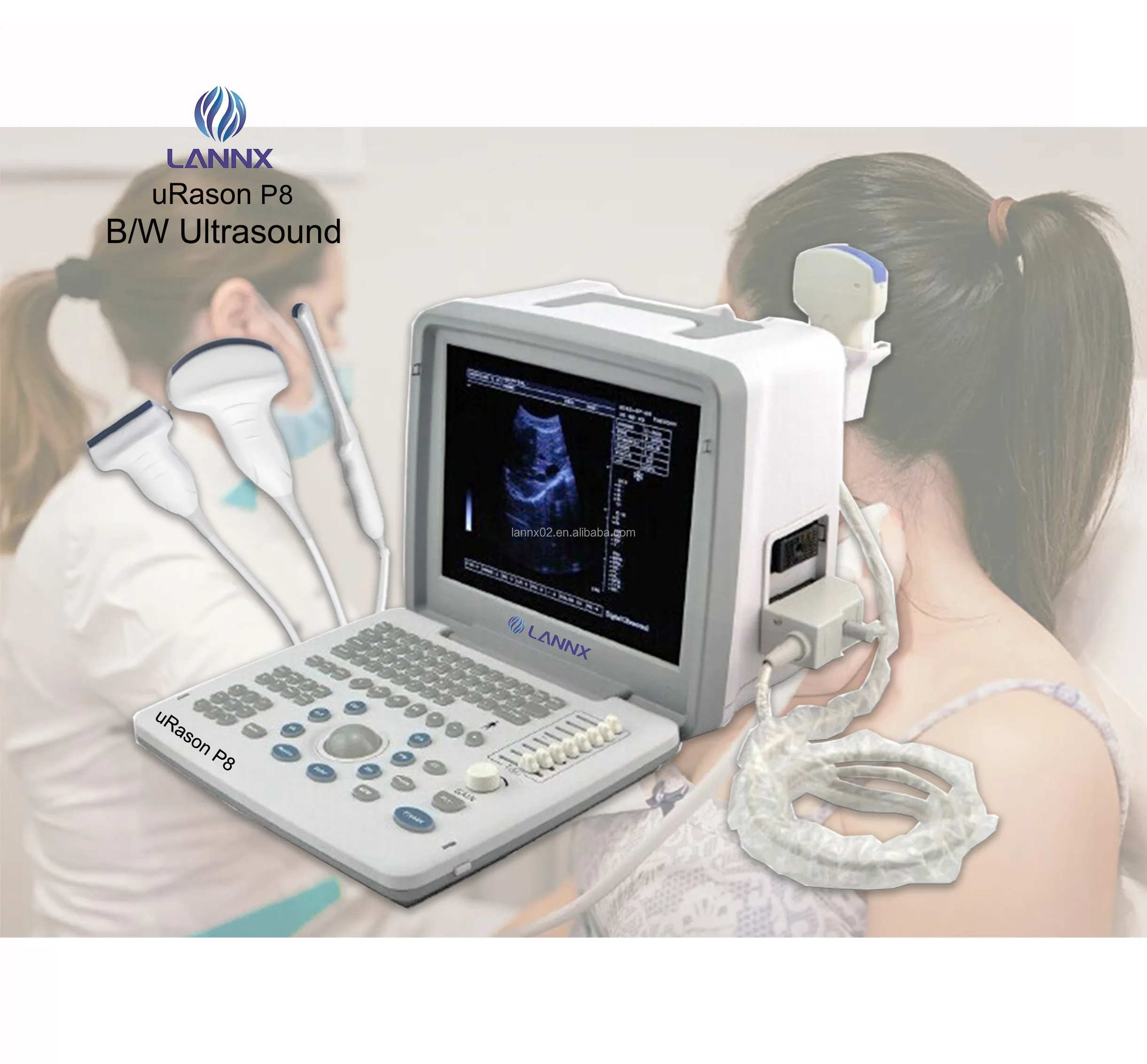 LANNX uRason P8 yüksek çözünürlüklü ekran tıbbi ekografi taşınabilir ultrason tam dijital ultrasonik teşhis makinesi
