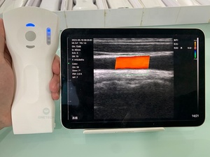 B26F <strong>the</strong> Highest 64 Channel 3 in 1 Handheld Wireless and Wired Color Doppler Ultrasound Scanner Probe for Windows IOS Android - Product Image 3