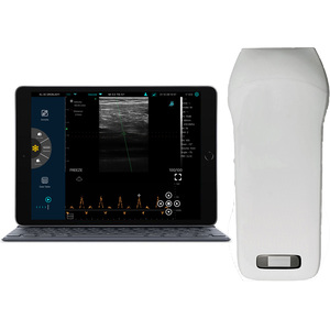 Konted MDR renkli Doppler 192 E 7.5/10Mhz kablosuz el düzenlenen lineer ultrason probu C10CX ameliyathane ve ortez için - Product Image 5