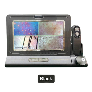 เครื่องสแกนหนังศีรษะ SA-S12วิเคราะห์หนังศีรษะแบบพกพา10ล้านพิกเซล - Product Image 2