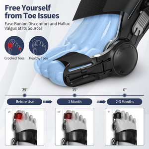 Корректор для женщин и мужчин, улучшенная Регулируемая ортопедическая шина для снятия боли в большом пальце ноги и выпрямления пальцев ног - Product Image 2