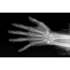 MEDSINGLONG New Model Digital Integrated Portable X-ray Machine High Frequency Handheld X-ray Machine with <strong>Computer</strong> <strong>System</strong> - Product Image 6