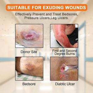 เคลือบโฟมซิลิโคนกันน้ําขนาดใหญ่พร้อมขอบกาว ผ้าพันแผลดูแลแผลดูดซับสูง - Product Image 4