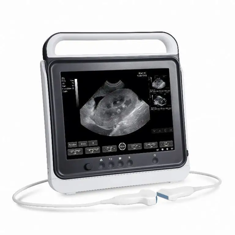Máquina de ultrasonido portátil, dispositivo médico de PW, CW, DICOM, cardiología, para clínica hospitalaria