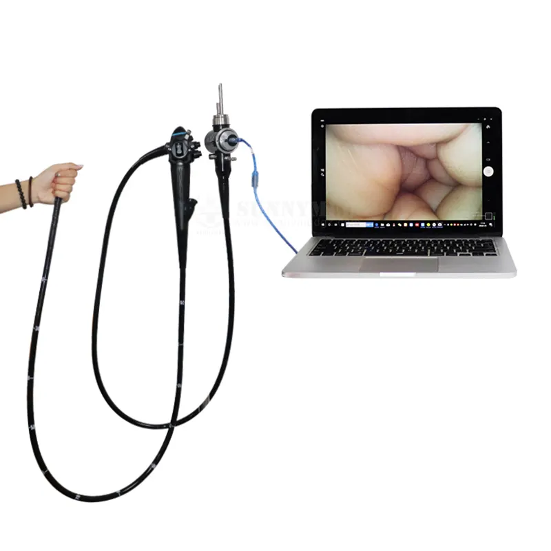 Ureteroscopio/cistoscopio/GASTROSCOPIO/colonoscopio/endoscopio otorrinolaringológico/laringoscopio, endoscopia veterinaria, Flexible, digital, de tipo digital, a prueba de agua, para endoscopia