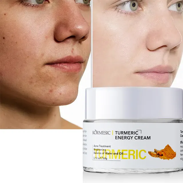 KORMESIC OEM atacado creme facial para cuidados com a pele de marca própria creme facial clareador Energy açafrão