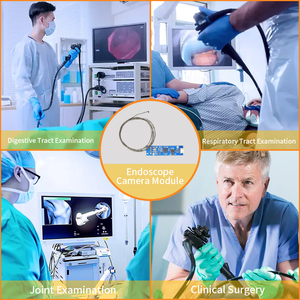 Ultra küçük 1.5mm çap endoskop modülü OCHFA10 görüntü sensörü tıbbi Borescope kamera modülü ile yan kamera