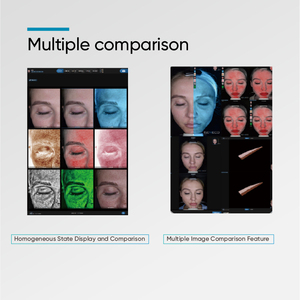 MEICET Best Digital Skin Analyzer <strong>Device</strong> 3D AI Technology LED Light Facial Skin Machine Face Analysis Machine EU IT JP US WiFi