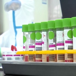 Örnekleri koleksiyonu set tüp ve akın çubukla oral burun swablar testi depolama - Product Image 3