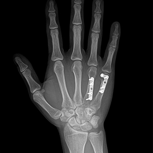 <strong>Matching</strong> with CR, DR System 17*17 Inch Digital X Ray <strong>Flat</strong> Panel Detector - Product Image 6