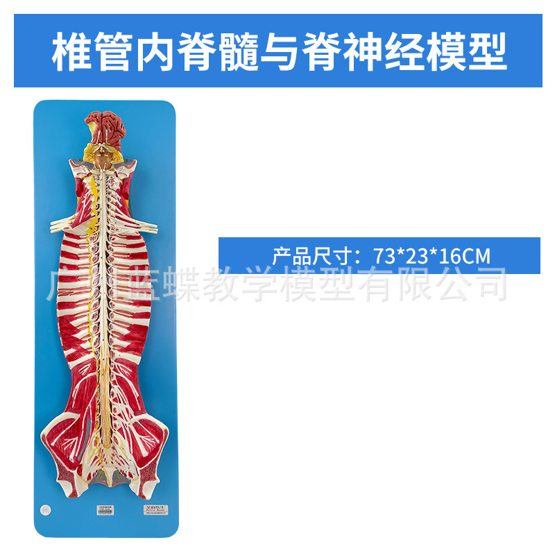 Modelo intraspinal de la médula espinal y los nervios espinales.