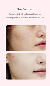 This Multi-functional Facial <strong>Introduction</strong> Device Activates the Skin Base and Bids Farewell to Ineffective Skin Care - Product Image 4