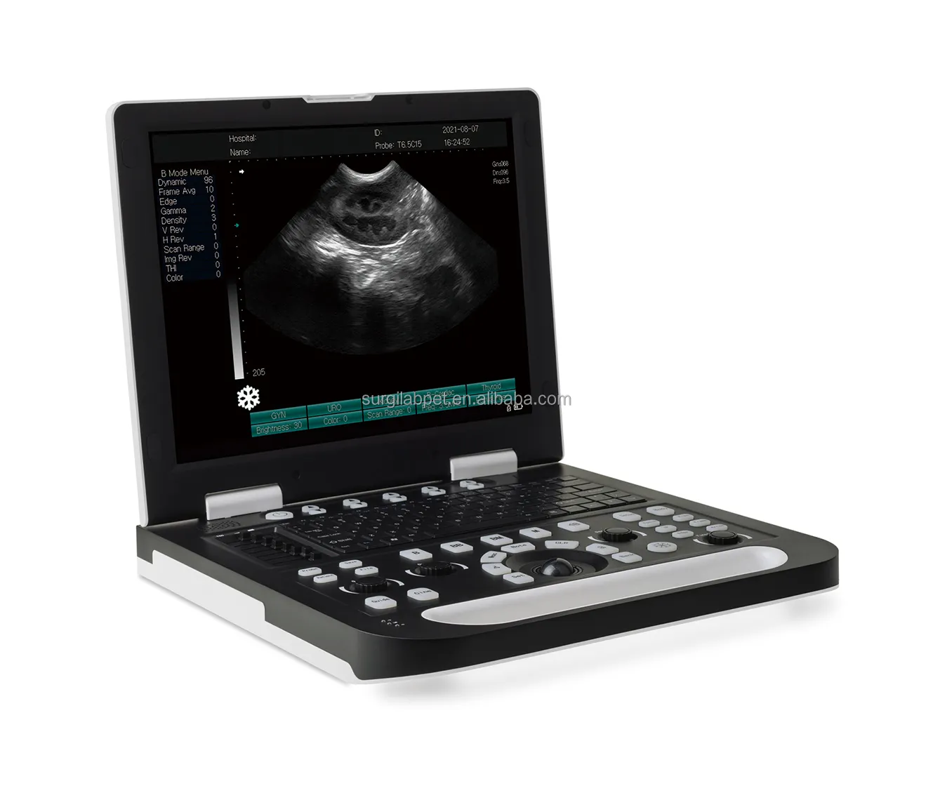 Máquina de ultrasonido con pantalla LCD de 15 pulgadas veterinaria, sonda de matriz convexa, sistema de ultrasonido portátil Digital completo para todos los animales