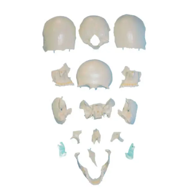 GD/General Doctor Tamaño real Hueso disperso de cráneo parcial Modelo Ciencia médica