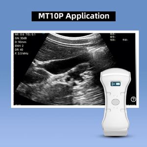 Draagbare Kleur <span class=keywords><strong>Doppler</strong></span> Ultrasone Systeem Prijs Draadloze Echografie Sonde - Product Image 6