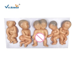 Malformation <strong>Fetuses</strong> Model Silicone <strong>Human</strong> Anatomical Model Medical Teaching Aids Model - Product Image 1