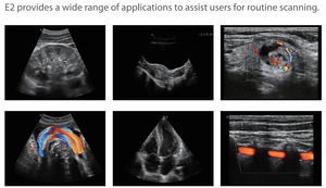 E1 E2 E2v <span class=keywords><strong>Sonoscape</strong></span> Portátil Ultrassom Scanner Ecocardiógrafo Doppler Colorido - Product Image 4