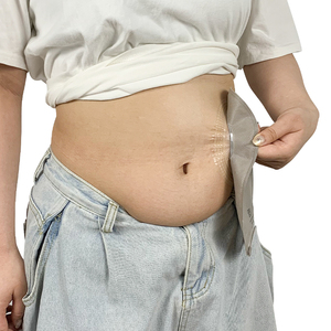 Produsen kantong kolostomi medis sekali pakai, persediaan kolostomi inkontinent - Product Image 4