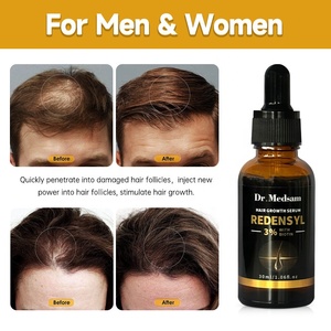 Natural Organic Biotin Rosemary Hair Growth <strong>Oil</strong> Men &amp; Women Scalp Hair Care Products OEM - Product Image 4